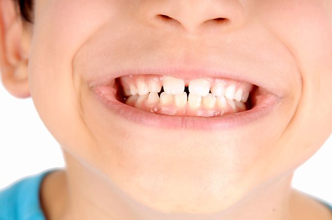 Ксилит для здоровья зубов ребенка